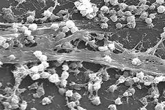 Microphotograph of a biofilm that can be found before air-conditioning decontamination.